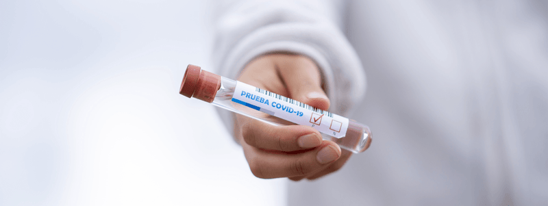 PCR vs. Rapid Test: When is it Better to Use a Rapid Antigen Test? - VITAL+ Pharmacy
